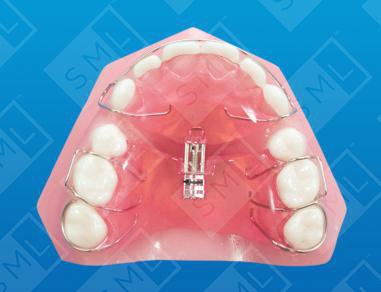 Retraction Expansion Screws