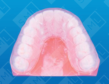 Standard Mouthguard