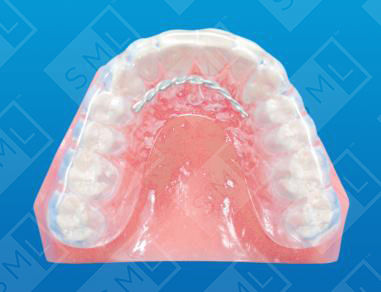 Superior Repositioning Splint