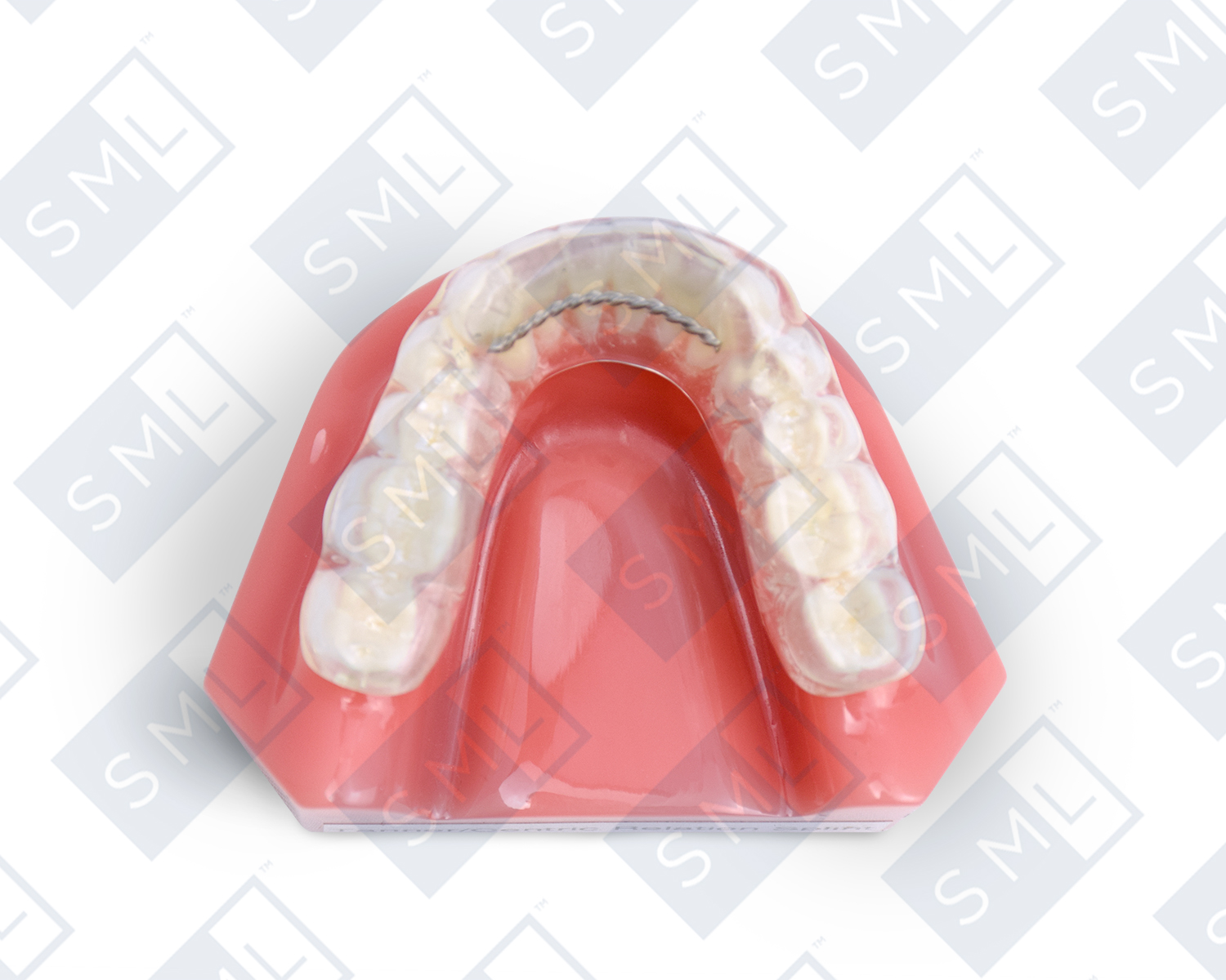 Tanner-Centric Relation Splint_1_watermarked