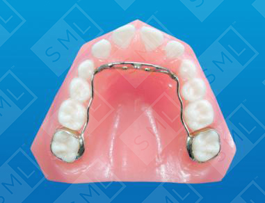 Tongue Fence