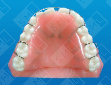 Upper Active Partial