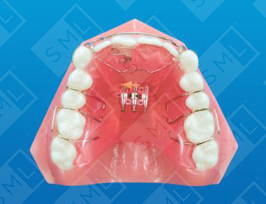 Upper Anterior Developer