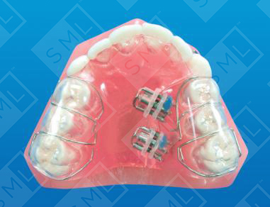 Witzig Crossbite App