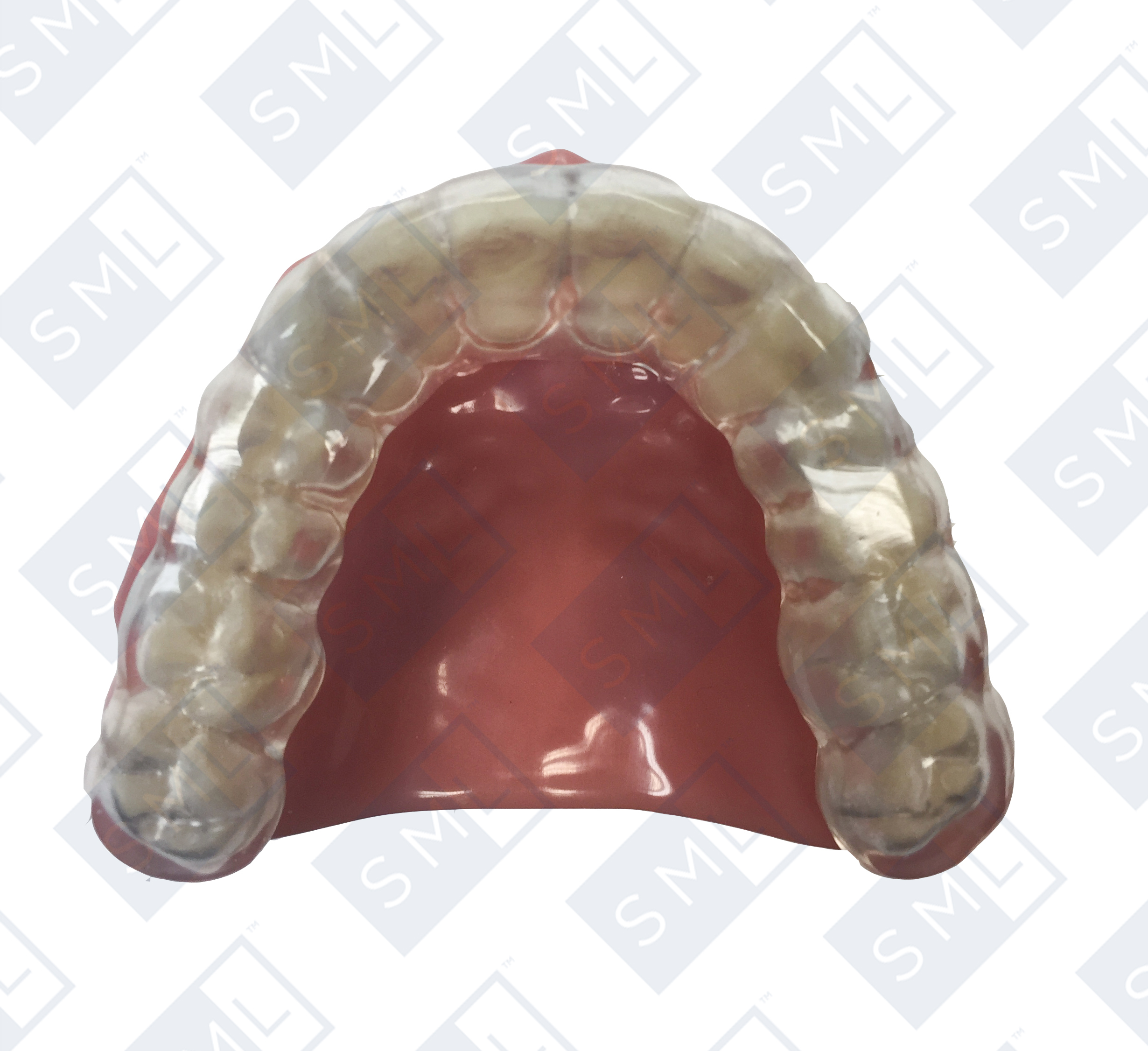 ataii-cr-splint