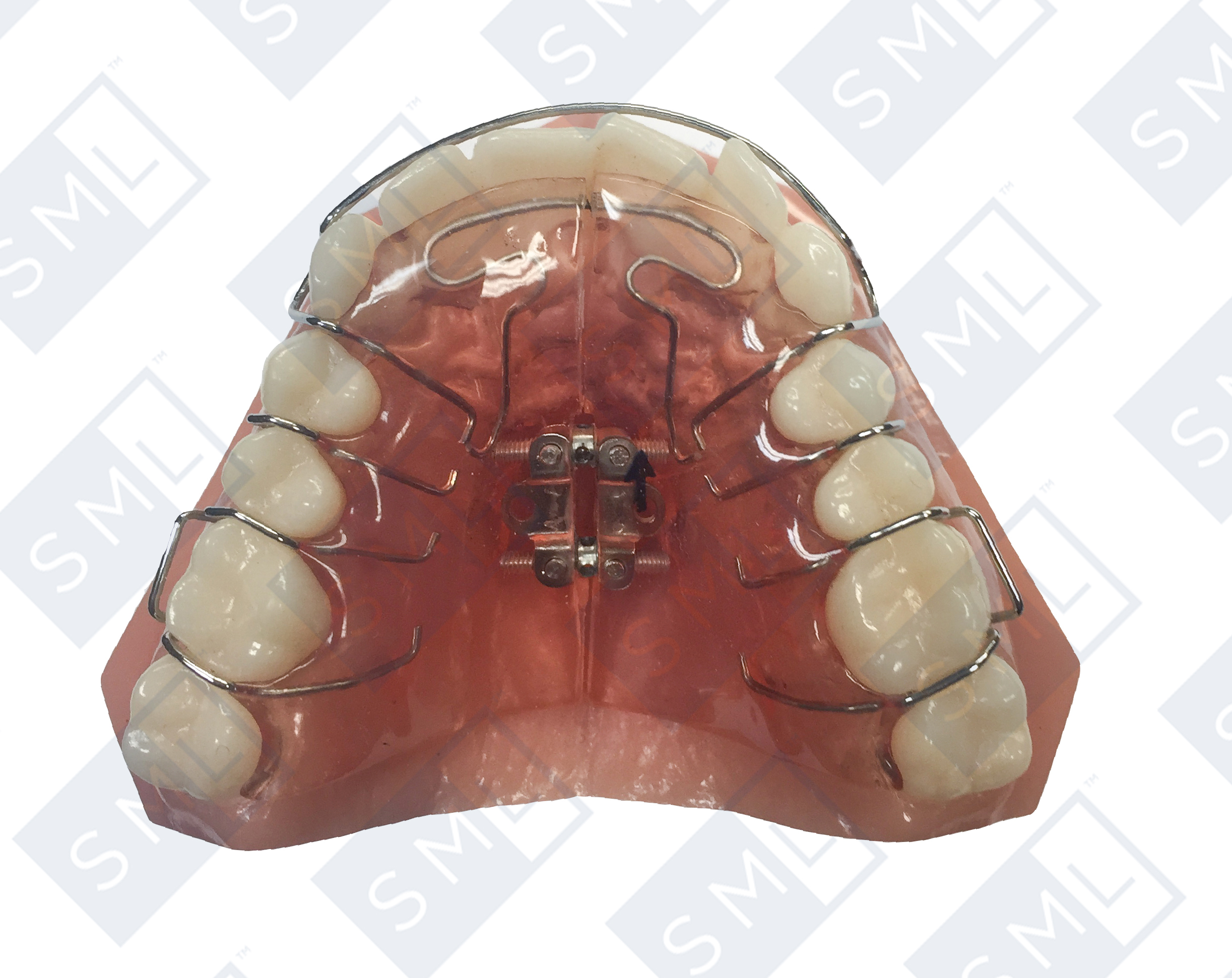 bifan-expansion-screw