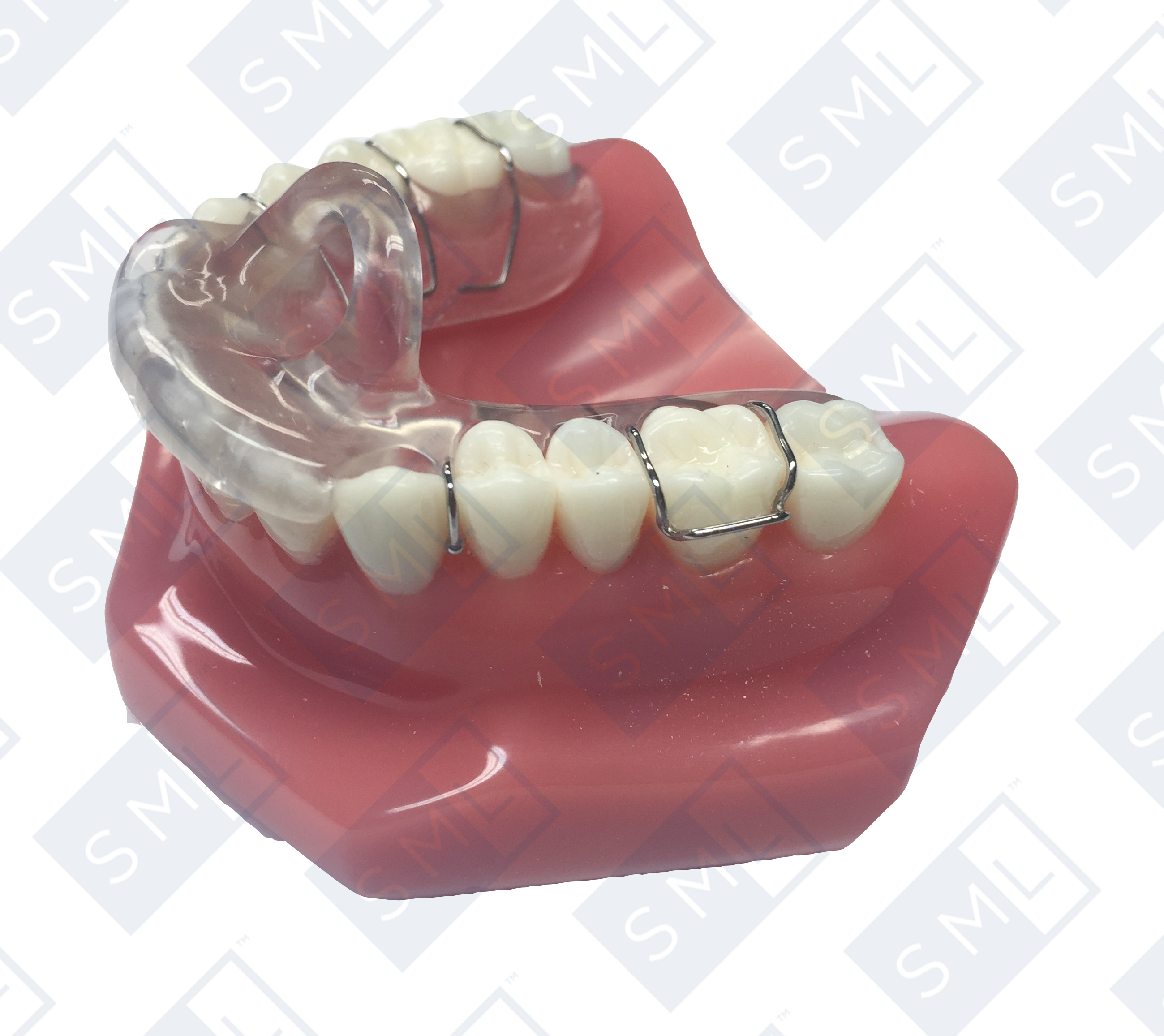 farrai-splint3
