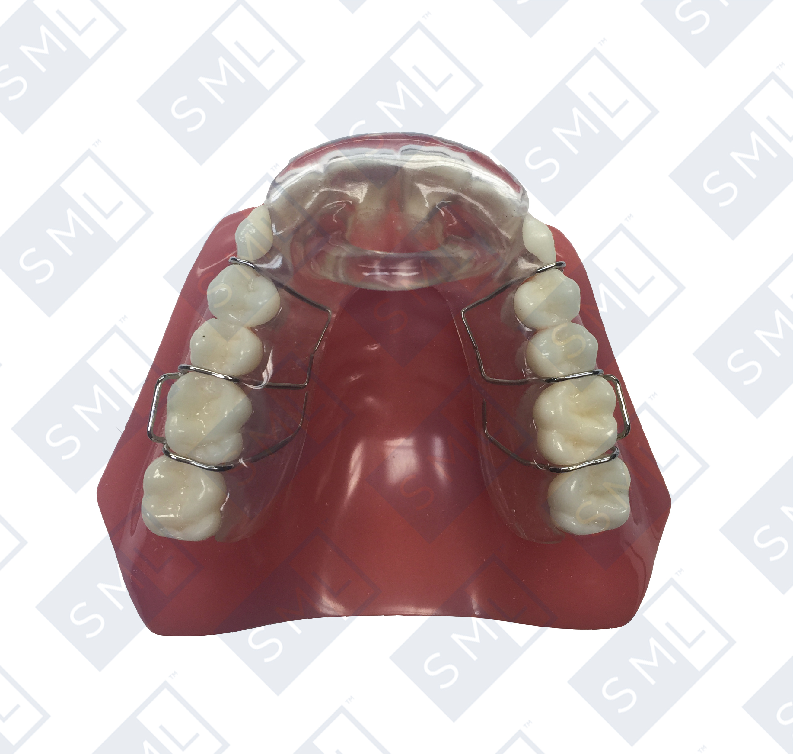 farrari-splint2