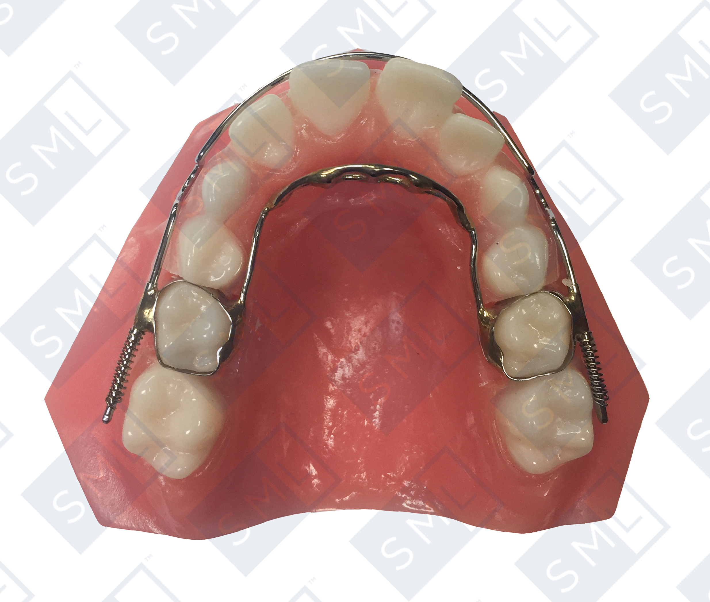 habit-with-retraction-labial.jpg.jpg