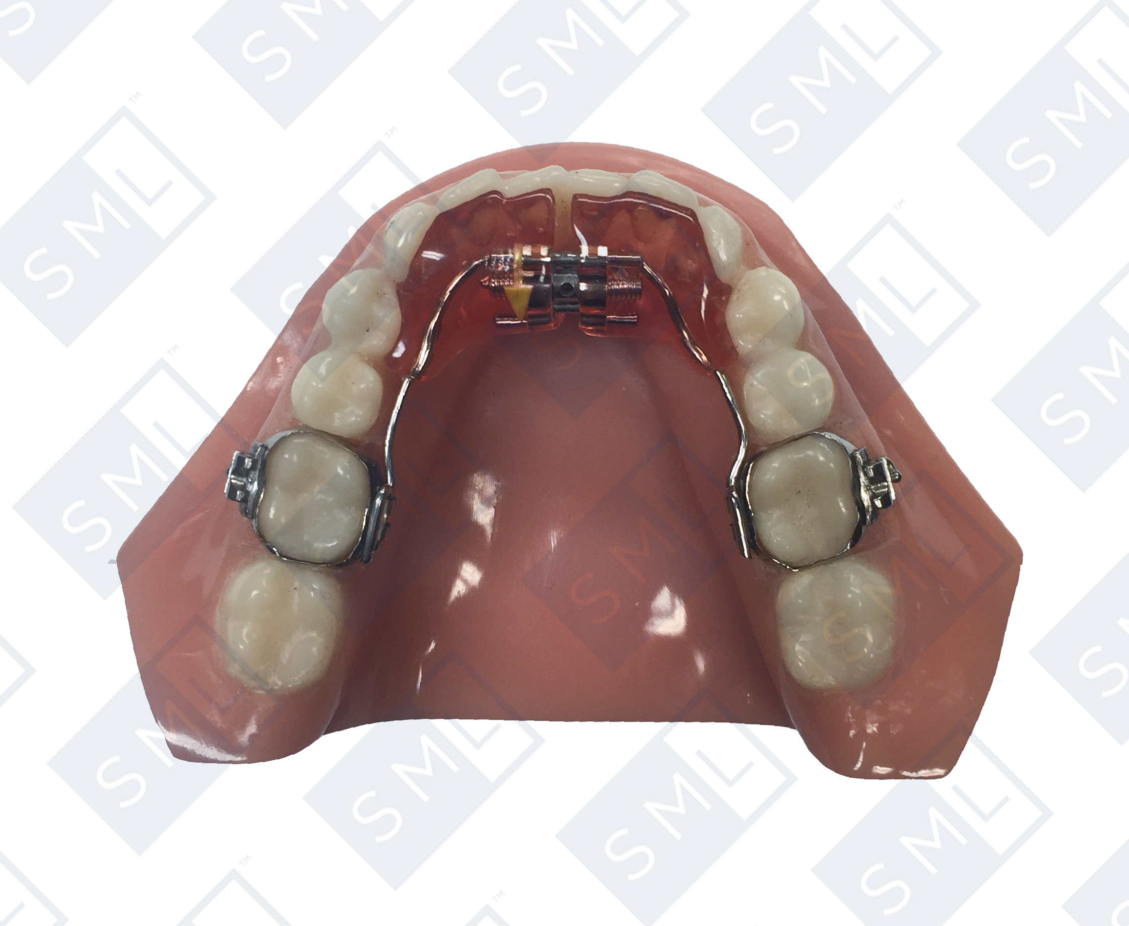 mandibular-gordon