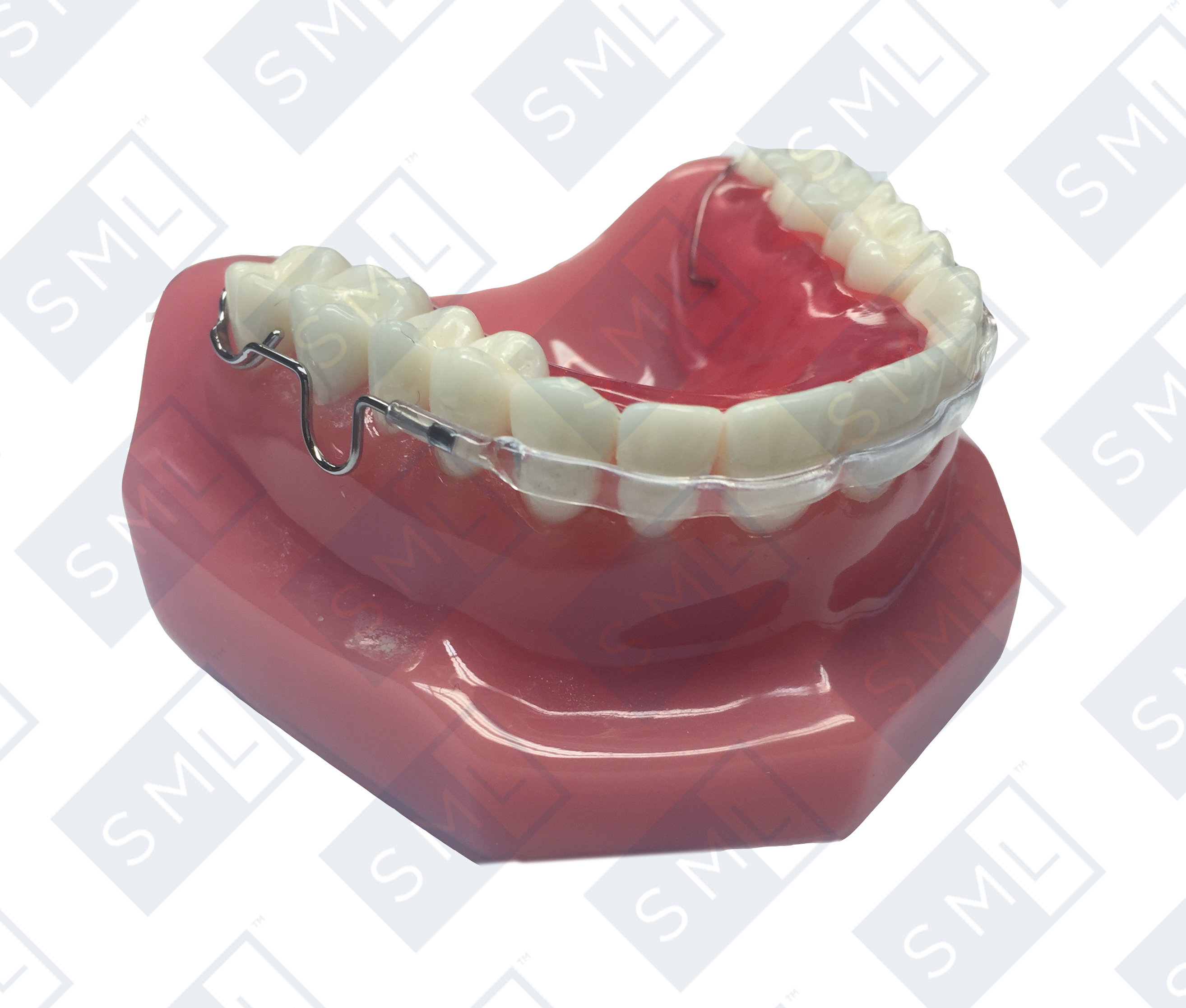 qcm-retainer1.jpg