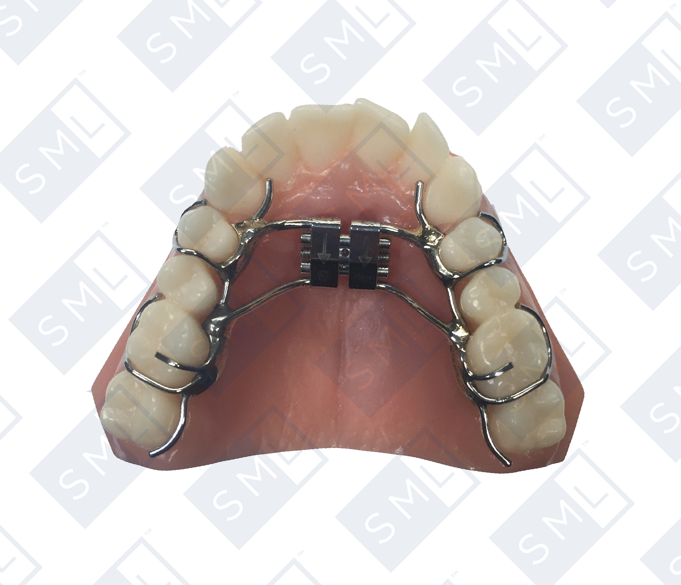 removeable-acrylic-free-expander.jpg.jpg
