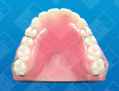 Upper Interim Removable Partial_0_0