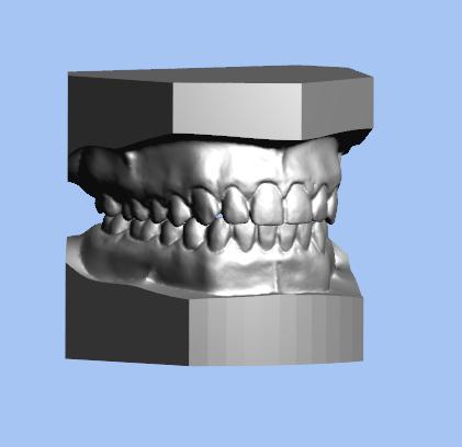 3D digital model
