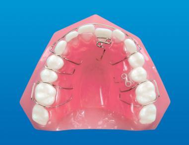 Recurved finger splint