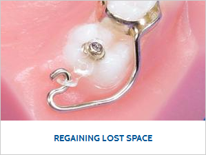 Regaining Lost Space_0