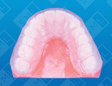 standard mouthguard