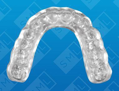 Dual Laminate Splints