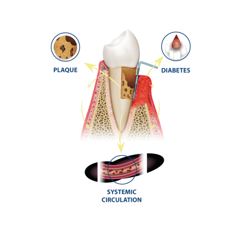 plaque teeth