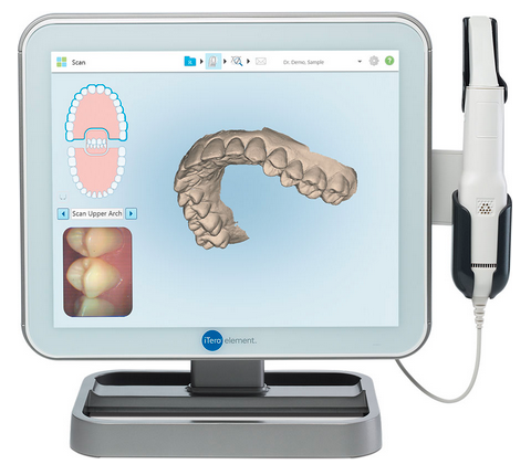 itero scanner