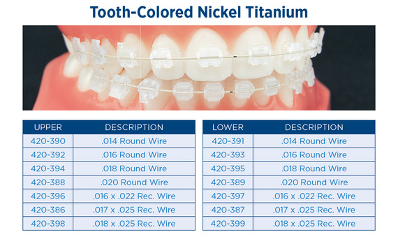 Tooth Colored Nickel Titanium