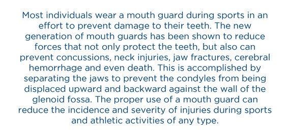 Mouth guards content