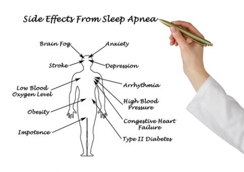 Sleep Apnea