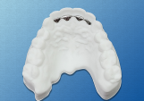 Bonded Retainer_0