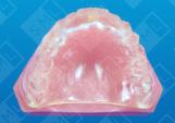 CT Scan Appliance for the fully edentulous patient