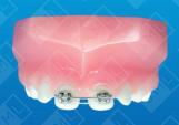 Diastema Controller_0
