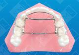 Inter-Oral Face Mask