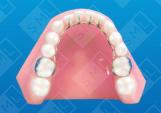 Lower Tongue Thrust_0