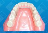 MORA gelb with anatomical occlusion