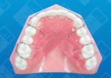 Max Final Retainer