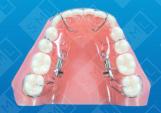 Posterior Space Closure_1