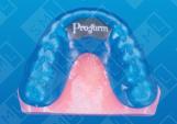 ProForm Mouthguard
