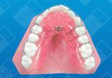 Reduced Acrylic Shwarz