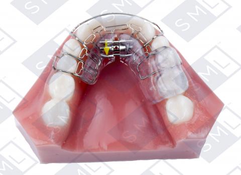 HomeoBlock Retainer