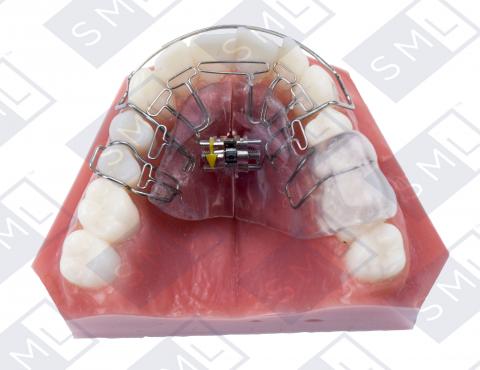 HomeoBlock Retainer